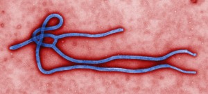 Microfotografia do vírus ebola